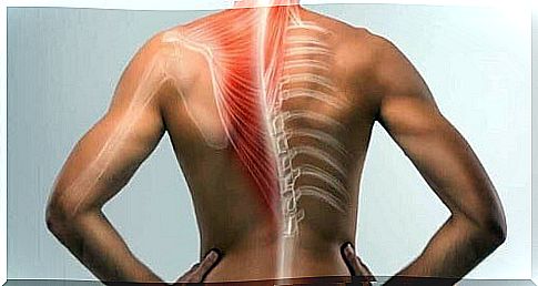 Back and tension myositis.