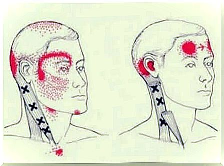 Cervicogenic headache, heads and types of headaches.